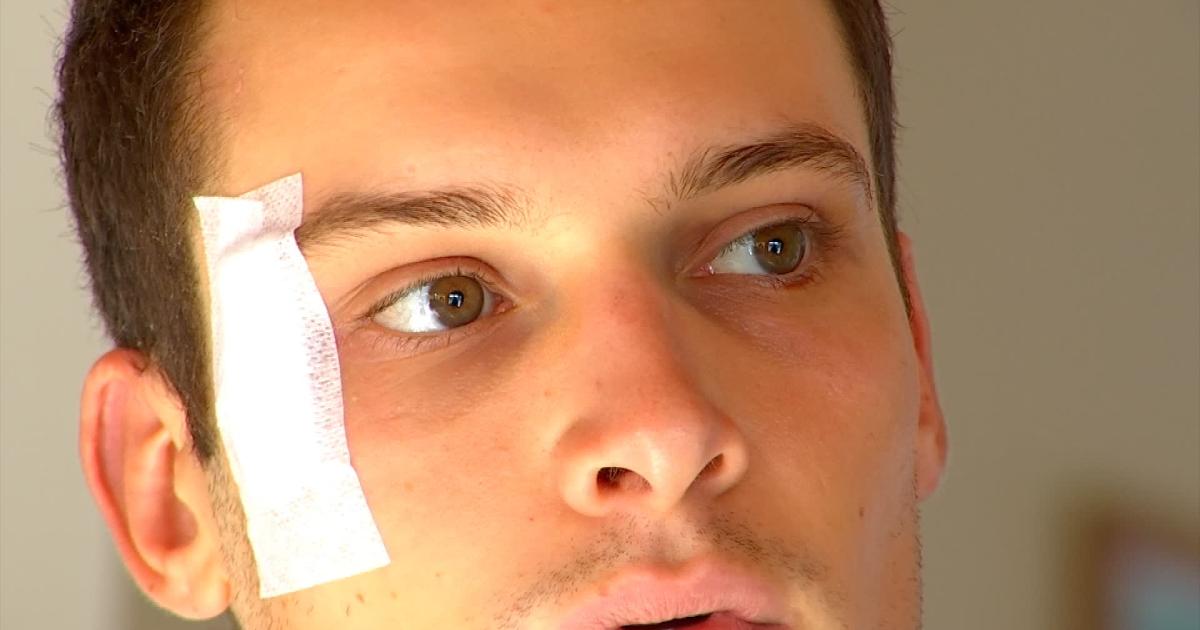 Sébastien Grignard se remet peu à peu de sa blessure Tele MB