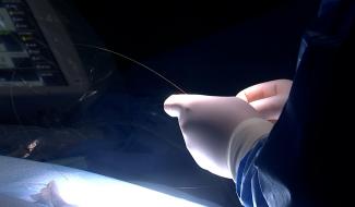 Au CHU EPICURA, une nouvelle technologie pour lutter contre les infarctus